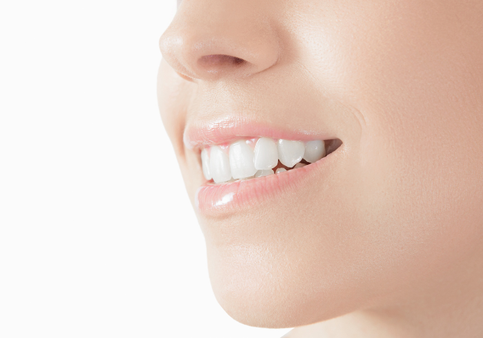 ワンデー治療（セレック）のイメージ