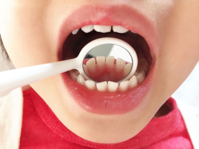 歯のチェック
