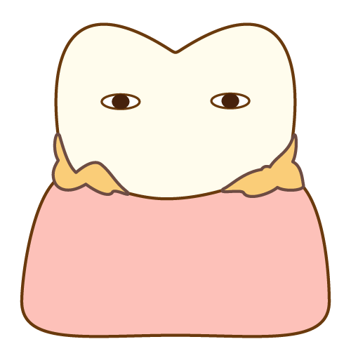 プラークの溜まった歯のイラスト